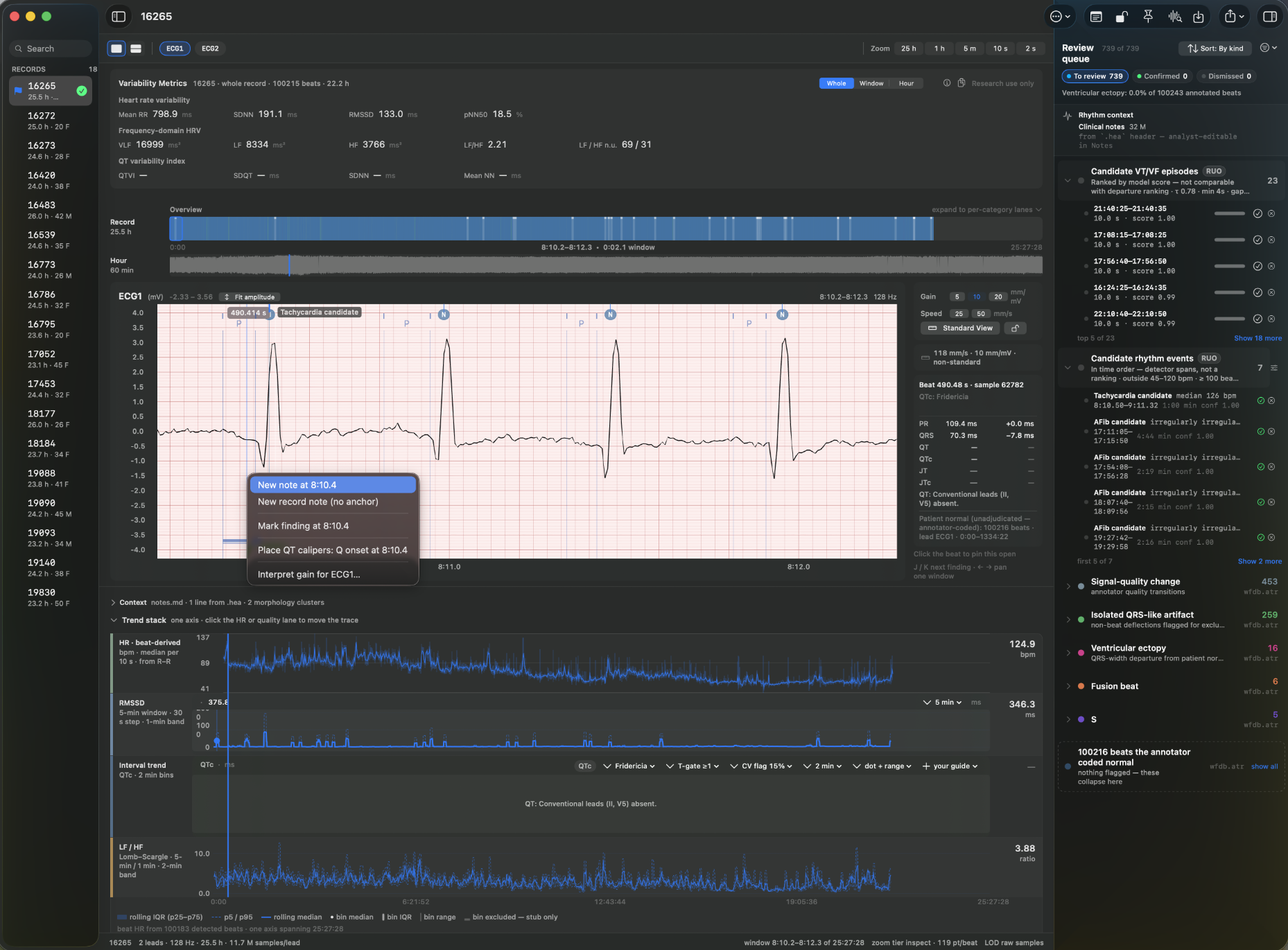 Murmur Studio main window — record sidebar, bedside stage on calibrated ECG paper, and the ranked review queue.